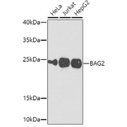 Western blot analysis of various lysates using BAG2 Antibody at 1/1000 dilution. Secondary antibody: HRP-conjugated Goat anti-Rabbit IgG (H+L) at 1/10000 dilution. Lysates/proteins: 25 µg per lane. Blocking buffer: 3% nonfat dry milk in TBST. Exposure time: 60s.