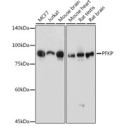 Western blot analysis of various lysates using PFKP Antibody at 1/1000 dilution. Secondary antibody: HRP-conjugated Goat anti-Rabbit IgG (H+L) at 1/10000 dilution. Lysates/proteins: 25 µg per lane. Blocking buffer: 3% nonfat dry milk in TBST. Exposure time: 1s.