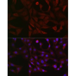 Phosphofructokinase, Platelet (PFKP) Antibody