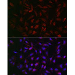 Phosphofructokinase, Platelet (PFKP) Antibody