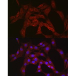 Phosphofructokinase, Platelet (PFKP) Antibody