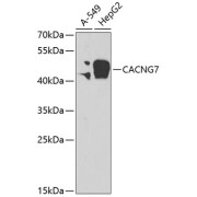 Western blot analysis of various lysates using CACNG7 Antibody at 1/2000 dilution. Secondary antibody: HRP-conjugated Goat anti-Rabbit IgG (H+L) at 1/10000 dilution. Lysates/proteins: 25 µg per lane. Blocking buffer: 3% nonfat dry milk in TBST. Exposure time: 90s.