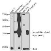 Western blot analysis of various lysates using Hemoglobin subunit alpha (HBA1) Antibody at 1/1000 dilution. Secondary antibody: HRP-conjugated Goat anti-Rabbit IgG (H+L) at 1/10000 dilution. Lysates/proteins: 25 µg per lane. Blocking buffer: 3% nonfat dry milk in TBST. Exposure time: 30s.