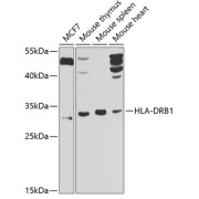 Western blot analysis of various lysates using HLA-DRB1 Antibody at 1/1000 dilution. Secondary antibody: HRP-conjugated Goat anti-Rabbit IgG (H+L) at 1/10000 dilution. Lysates/proteins: 25 µg per lane. Blocking buffer: 3% nonfat dry milk in TBST. Detection: ECL Basic Kit (RM00020). Exposure time: 30s.