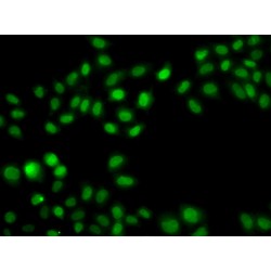 Sulfotransferase Family 2B Member 1 (SULT2B1) Antibody