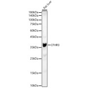 Western blot analysis of lysates from Rat liver, using CFHR3 Antibody at 1/1000 dilution. Secondary antibody: HRP-conjugated Goat anti-Rabbit IgG (H+L) at 1/10000 dilution. Lysates/proteins: 25 µg per lane. Blocking buffer: 3% nonfat dry milk in TBST. Exposure time: 30s.