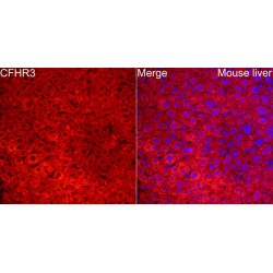 Complement Factor H Related 3 (CFHR3) Antibody