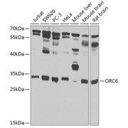 Western blot analysis of various lysates using ORC6 Antibody at 1/1000 dilution. Secondary antibody: HRP-conjugated Goat anti-Rabbit IgG (H+L) at 1/10000 dilution. Lysates/proteins: 25 µg per lane. Blocking buffer: 3% nonfat dry milk in TBST. Detection: ECL Basic Kit (RM00020). Exposure time: 30s.