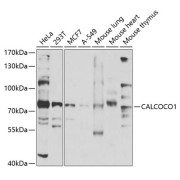 Western blot analysis of various lysates using CALCOCO1 Antibody at 1/1000 dilution. Secondary antibody: HRP-conjugated Goat anti-Rabbit IgG (H+L) at 1/10000 dilution. Lysates/proteins: 25 µg per lane. Blocking buffer: 3% nonfat dry milk in TBST. Exposure time: 90s.