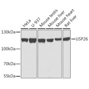 Western blot analysis of various lysates using USP26 Antibody at 1/1000 dilution. Secondary antibody: HRP-conjugated Goat anti-Rabbit IgG (H+L) at 1/10000 dilution. Lysates/proteins: 25 µg per lane. Blocking buffer: 3% nonfat dry milk in TBST. Exposure time: 30s.