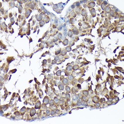 Monofunctional C1-Tetrahydrofolate Synthase, Mitochondrial (MTHFD1L) Antibody