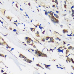 Muscleblind-Like Protein 1 (MBNL1) Antibody