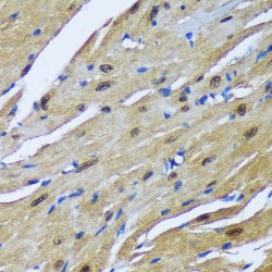 Muscleblind-Like Protein 1 (MBNL1) Antibody