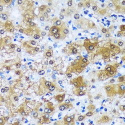 Muscleblind-Like Protein 1 (MBNL1) Antibody