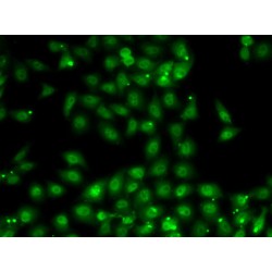 Muscleblind-Like Protein 1 (MBNL1) Antibody