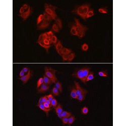 Large Neutral Amino Acid Transporter 1 / LAT1 (SLC7A5) Antibody