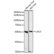 Western blot analysis of various lysates using LAG3 Antibody at 1/500 dilution. Secondary antibody: HRP-conjugated Goat anti-Rabbit IgG (H+L) at 1/10000 dilution. Lysates/proteins: 25 µg per lane. Blocking buffer: 3% nonfat dry milk in TBST. Exposure time: 90s.