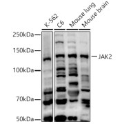 Western blot analysis of various lysates using JAK2 Antibody at 1/500 dilution. Secondary antibody: HRP-conjugated Goat anti-Rabbit IgG (H+L) at 1/10000 dilution. Lysates/proteins: 25 µg per lane. Blocking buffer: 3% nonfat dry milk in TBST. Exposure time: 180s.