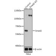 Western blot analysis of lysates from wild type (WT) and Smad2 knockout (KO) HeLa cells, using [KO Validated] Smad2 Antibody at 1/1000 dilution. Secondary antibody: HRP-conjugated Goat anti-Rabbit IgG (H+L) at 1/10000 dilution. Lysates/proteins: 25 µg per lane. Blocking buffer: 3% nonfat dry milk in TBST. Exposure time: 5min.