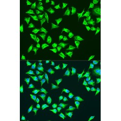 ATP Synthase Subunit A (ATP6) Antibody