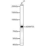 Western blot analysis of various lysates using ADAMTS5 Antibody at 1/2000 dilution. Secondary antibody: HRP-conjugated Goat anti-Rabbit IgG (H+L) at 1/10000 dilution. Lysates/proteins: 25 µg per lane. Blocking buffer: 3% nonfat dry milk in TBST. Negative control (NC): THP-1. Exposure time: 20s.