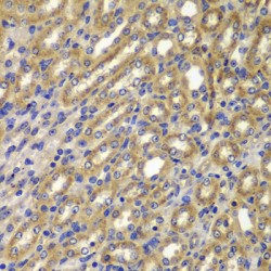 Cyclin-A2 (CCNA2) Antibody