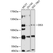 Western blot analysis of various lysates using DIS3 Antibody at 1/1000 dilution. Secondary antibody: HRP-conjugated Goat anti-Rabbit IgG (H+L) at 1/10000 dilution. Lysates/proteins: 25 µg per lane. Blocking buffer: 3% nonfat dry milk in TBST. Exposure time: 5s.