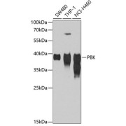 Western blot analysis of various lysates using SPK Antibody at 1/1000 dilution. Secondary antibody: HRP-conjugated Goat anti-Rabbit IgG (H+L) at 1/10000 dilution. Lysates/proteins: 25 µg per lane. Blocking buffer: 3% nonfat dry milk in TBST. Exposure time: 90s.