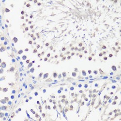 SPK Antibody