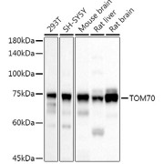 Western blot analysis of various lysates using TOM70 Antibody at 1/500 dilution. Secondary antibody: HRP-conjugated Goat anti-Rabbit IgG (H+L) at 1/10000 dilution. Lysates/proteins: 25 µg per lane. Blocking buffer: 3% nonfat dry milk in TBST. Exposure time: 10s.