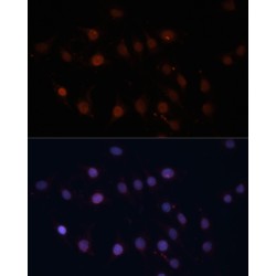 Mitochondrial Import Receptor Subunit TOM70 (TOMM70) Antibody