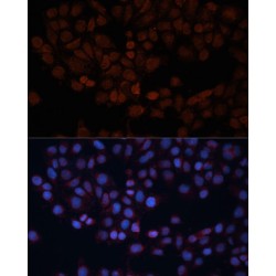 Mitochondrial Import Receptor Subunit TOM70 (TOMM70) Antibody