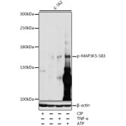 Western blot analysis of various lysates using Phospho-MAP3K5-S83 Antibody at 1/1000 dilution. K562 cell lysate were treated by CIP (20 µl CIP for each 400 µl cell lysate) at 37 °C for 1 hour, treated by TNF-α (20ng/ml) for 30 minutes after serum-starvation overnight or treated by ATP (5mM) at 30 °C for 1 hour. Secondary antibody: HRP-conjugated Goat anti-Rabbit IgG (H+L) at 1/10000 dilution. Lysates/proteins: 25 µg per lane. Blocking buffer: 3% BSA. Exposure time: 60s.