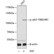 Western blot analysis of lysates from 293T cells, using Phospho-Jak3-Y980/981 Antibody. Secondary antibody: HRP-conjugated Goat anti-Rabbit IgG (H+L) at 1/10000 dilution. Lysates/proteins: 25 µg per lane. Blocking buffer: 3% BSA.