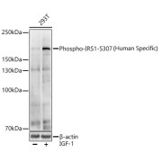 Western blot analysis of various lysates using Phospho-IRS1-S307(Human Specific) Antibody at 1/1000 dilution. 293T cells were treated by IGF-1 (50 ng/ml) at 37 °C for 5 minutes after serum-starvation overnight. Secondary antibody: HRP-conjugated Goat anti-Rabbit IgG (H+L) at 1/10000 dilution. Lysates/proteins: 25 µg per lane. Blocking buffer: 3% nonfat dry milk in TBST. Exposure time: 30s.