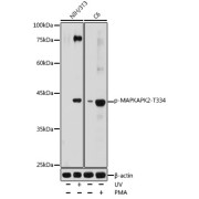 Western blot analysis of various lysates using Phospho-MAPKAPK-2/MK2-T334 Antibody at 1/1000 dilution. NIH/3T3 cells were treated by UV at room temperature for 15-30 minutes. C6 cells were treated by PMA/TPA (200 nM) at 37 °C for 30 minutes after serum-starvation overnight. Secondary antibody: HRP-conjugated Goat anti-Rabbit IgG (H+L) at 1/10000 dilution. Lysates/proteins: 25 µg per lane. Blocking buffer: 3% nonfat dry milk in TBST. Exposure time: 180s.