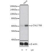 Western blot analysis of lysates from HeLa cells, using Phospho-Chk2-T68 Antibody. HeLa cells were treated by UV for 15-30 minutes. Secondary antibody: HRP-conjugated Goat anti-Rabbit IgG (H+L) at 1/10000 dilution. Lysates/proteins: 25 µg per lane. Blocking buffer: 3% BSA.