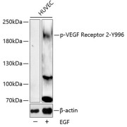 Western blot analysis of lysates from HUVEC cells, using Phospho-VEGF Receptor 2-Y996 Antibody. Secondary antibody: HRP-conjugated Goat anti-Rabbit IgG (H+L) at 1/10000 dilution. Lysates/proteins: 25 µg per lane. Blocking buffer: 3% BSA.