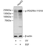 Western blot analysis of lysates from HepG2 cells, using Phospho-PDGFR alpha-Y1018 Antibody at 1/1000 dilution. HepG2 cells were treated by UV for 15-30 minutes or treated by EGF (100ng/ml) for 30 minutes after serum-starvation overnight. Secondary antibody: HRP-conjugated Goat anti-Rabbit IgG (H+L) at 1/10000 dilution. Lysates/proteins: 25 µg per lane. Blocking buffer: 3% BSA.