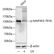 Western blot analysis of lysates from HeLa cells, using Phospho-MAP3K5-T918 Antibody at 1/1000 dilution. HeLa cells were treated by UV for 15-30 minutes. Secondary antibody: HRP-conjugated Goat anti-Rabbit IgG (H+L) at 1/10000 dilution. Lysates/proteins: 25 µg per lane. Blocking buffer: 3% BSA.