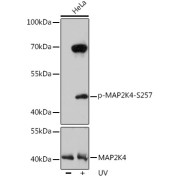 Western blot analysis of lysates from HeLa cells, using Phospho-MAP2K4-S257 Antibody. HeLa cells were treated by UV at room temperature for 15-30 minutes. Secondary antibody: HRP-conjugated Goat anti-Rabbit IgG (H+L) at 1/10000 dilution. Lysates/proteins: 25 µg per lane. Blocking buffer: 3% nonfat dry milk in TBST. Exposure time: 90s.