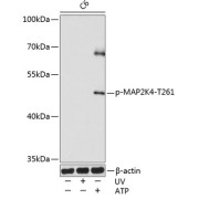 Western blot analysis of various lysates using Phospho-MAP2K4-T261 antibody at 1/1000 dilution. C6 cells were treated by UV at room temperature for 15-30 minutes or treated by ATP(5 mM) at 30 °C for 1 hour. Secondary antibody: HRP-conjugated Goat anti-Rabbit IgG (H+L) at 1/10000 dilution. Lysates/proteins: 25 µg per lane. Blocking buffer: 3% nonfat dry milk in TBST. Exposure time: 60s.