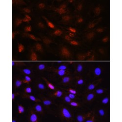 Jak1 (pY1022 / 1023) Antibody