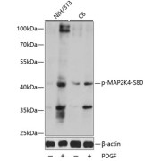 Western blot analysis of lysates from NIH/3T3 and C6 cells, using Phospho-MAP2K4-S80 Antibody at 1/1000 dilution. NIH/3T3 cells were treated by PDGF (100ng/ml) for 30 minutes after serum-starvation overnight or treated by PDGF (50 ng/ml) for 30 minutes after serum-starvation overnight. Secondary antibody: HRP-conjugated Goat anti-Rabbit IgG (H+L) at 1/10000 dilution. Lysates/proteins: 25 µg per lane. Blocking buffer: 3% BSA. Exposure time: 150s.