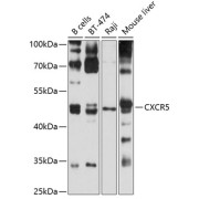 Western blot analysis of various lysates using CXCR5 Antibody at 1/1000 dilution. Secondary antibody: HRP-conjugated Goat anti-Rabbit IgG (H+L) at 1/10000 dilution. Lysates/proteins: 25 µg per lane. Blocking buffer: 3% nonfat dry milk in TBST. Exposure time: 10s.