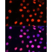 Immunofluorescence analysis of HeLa cells using MonoMethyl-NONO/p54nrb-R357/R365 antibody at dilution of 1/100 (40x lens). Secondary antibody: Cy3-conjugated Goat anti-Rabbit IgG (H+L) at 1/500 dilution. Blue: DAPI for nuclear staining.