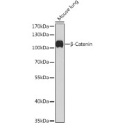 Western blot analysis of lysates from Mouse lung, using β-Catenin Antibody at 1/1000 dilution. Secondary antibody: HRP-conjugated Goat anti-Rabbit IgG (H+L) at 1/10000 dilution. Lysates/proteins: 25 µg per lane. Blocking buffer: 3% nonfat dry milk in TBST. Exposure time: 90s.