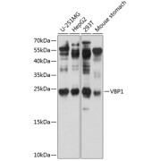 Western blot analysis of various lysates using VBP1 Antibody at 1/1000 dilution. Secondary antibody: HRP-conjugated Goat anti-Rabbit IgG (H+L) at 1/10000 dilution. Lysates/proteins: 25 µg per lane. Blocking buffer: 3% nonfat dry milk in TBST. Exposure time: 1s.