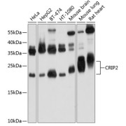 Western blot analysis of various lysates using CRIP2 Antibody at 1/1000 dilution. Secondary antibody: HRP-conjugated Goat anti-Rabbit IgG (H+L) at 1/10000 dilution. Lysates/proteins: 25 µg per lane. Blocking buffer: 3% nonfat dry milk in TBST. Exposure time: 30s.