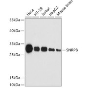 Western blot analysis of various lysates using SNRPB Antibody at 1/3000 dilution. Secondary antibody: HRP-conjugated Goat anti-Rabbit IgG (H+L) at 1/10000 dilution. Lysates/proteins: 25 µg per lane. Blocking buffer: 3% nonfat dry milk in TBST. Exposure time: 180s.